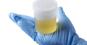 synthetic urine