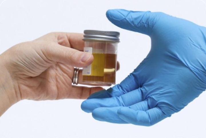 Choosing the Right Synthetic Urine
